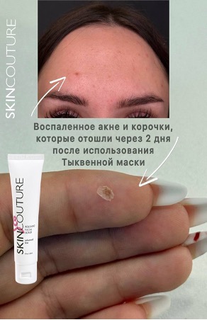 Нанесение маски